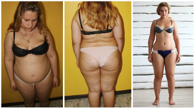 Зависимой от сахара женщине удалось похудеть на 40 килограммов